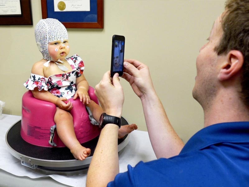 Baby Cranial Helmet