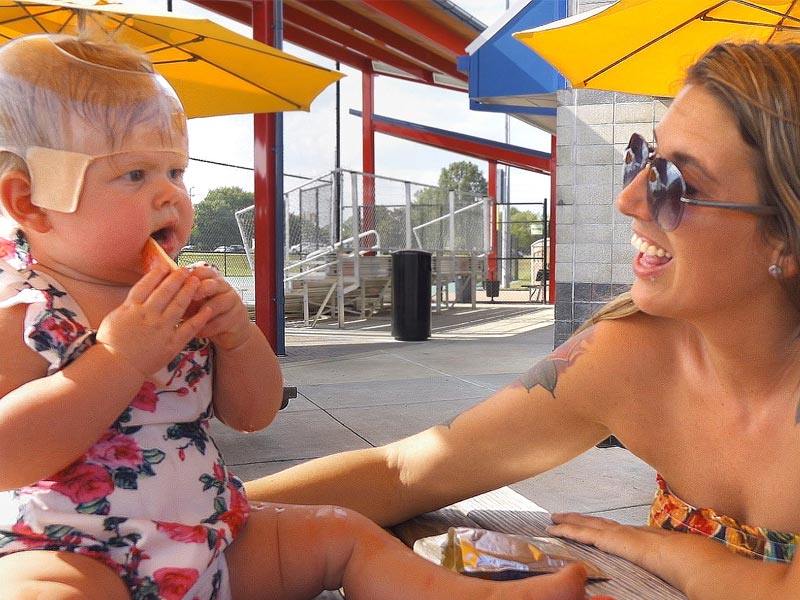 Cranial Helmets for Babies