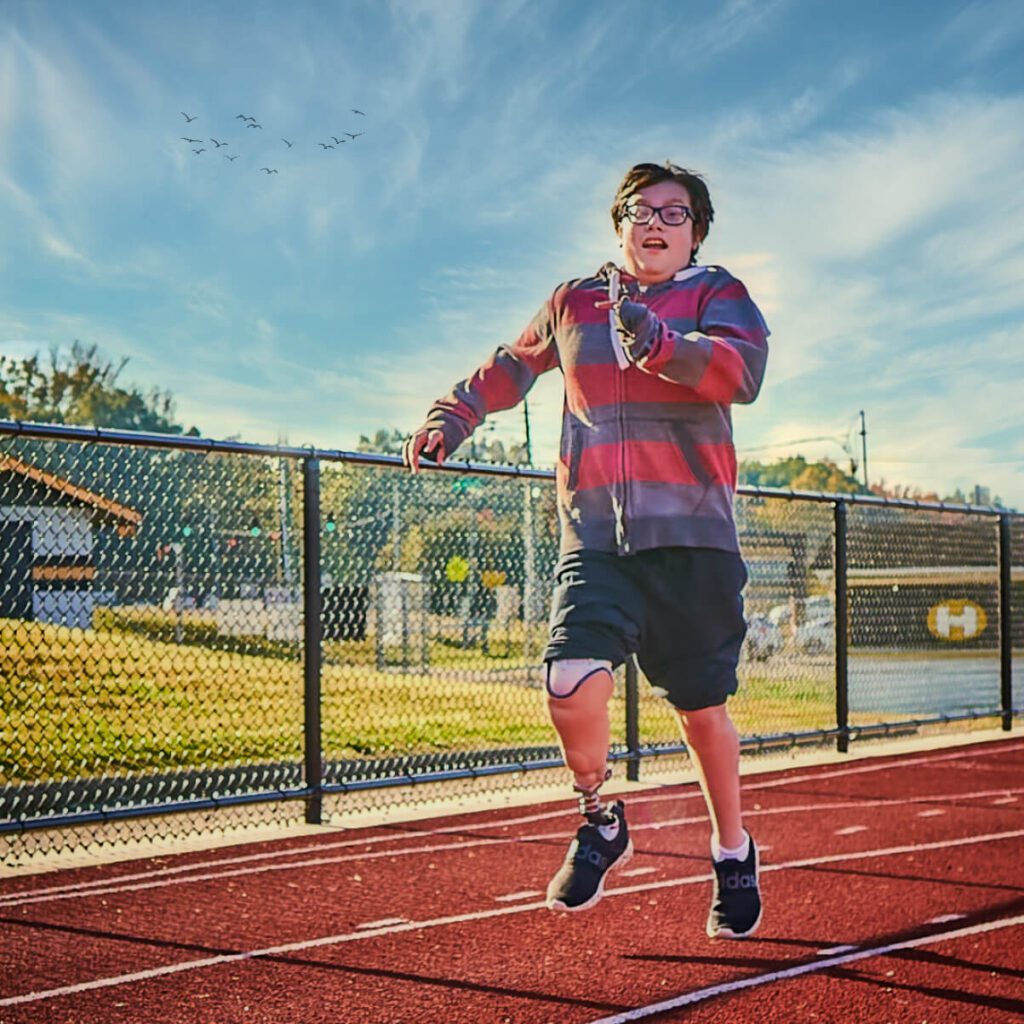 Pediatric Prosthetics in Tennessee