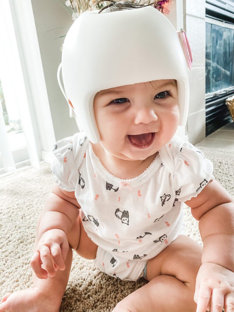 Cranial Helmets for kids